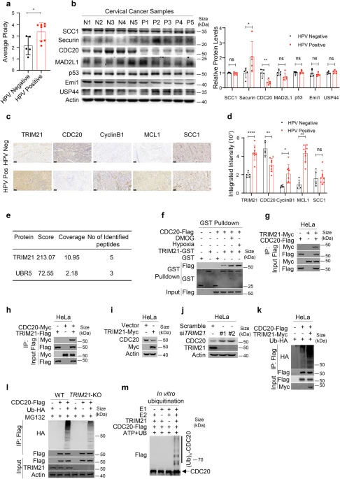 Mechanistische studie toont hoe hypoxie en infectie via CDC20-afbraak aneuploïdie en chemoresistentie bevorderen