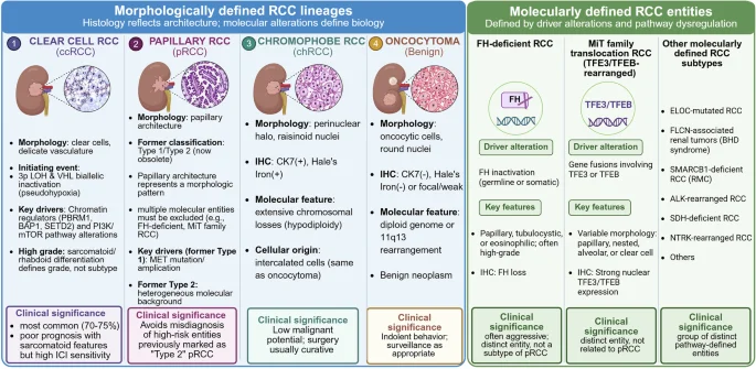 Integrale review belicht moleculaire evolutie en nieuwe therapieën bij niercelcarcinoom